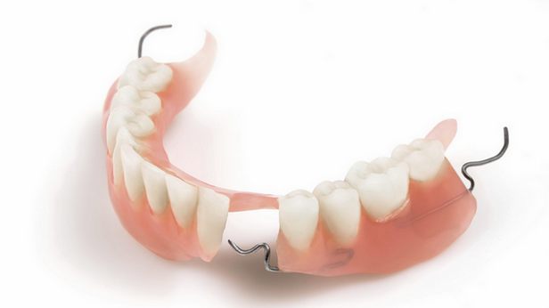 Частичный акриловый зубной протез
