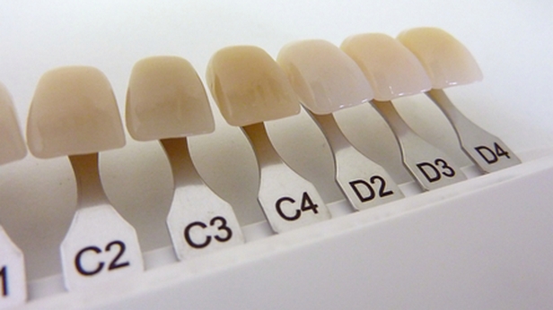 Фото: Подбор цвета зубной конструкции